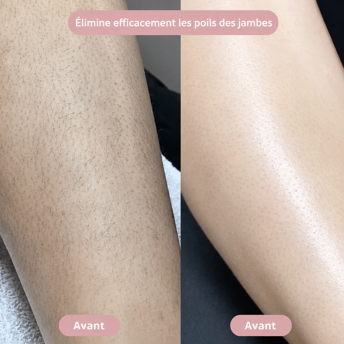 SilkySkin – Le rasage intime sans irritation