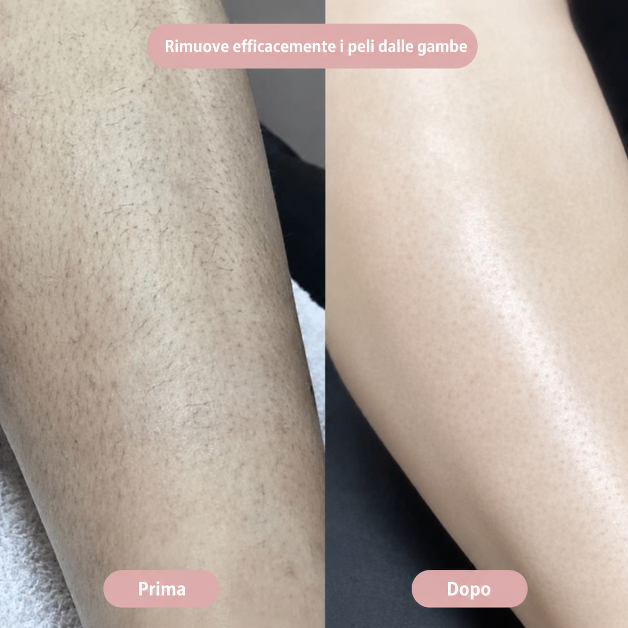 SilkySkin – Depilazione intima senza irritazioni